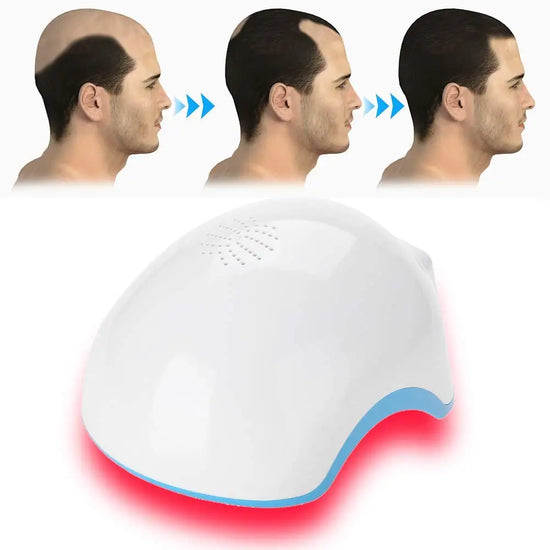 2025 New 272 Diode Red Laser Hair Growth Helmet, Used For Anti-Hair Loss and Laser Hair Growth Treatment